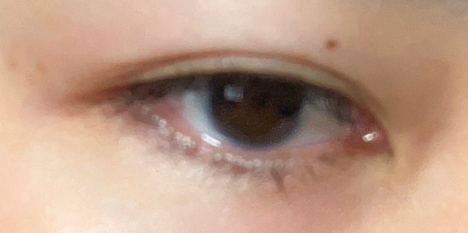 TWOOL ダブルアイリッドグルー/SHOBIDO/二重まぶた用アイテムを使ったクチコミ(3枚目)