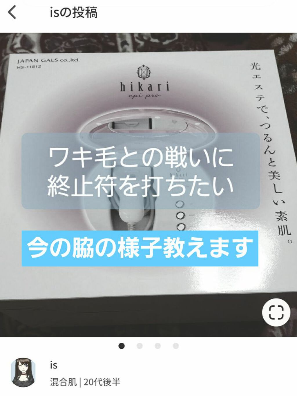 hikari epi pro/ジャパンギャルズ/家庭用脱毛器を使ったクチコミ(1枚目)