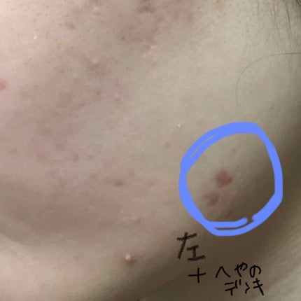 を使ったクチコミ(1枚目)