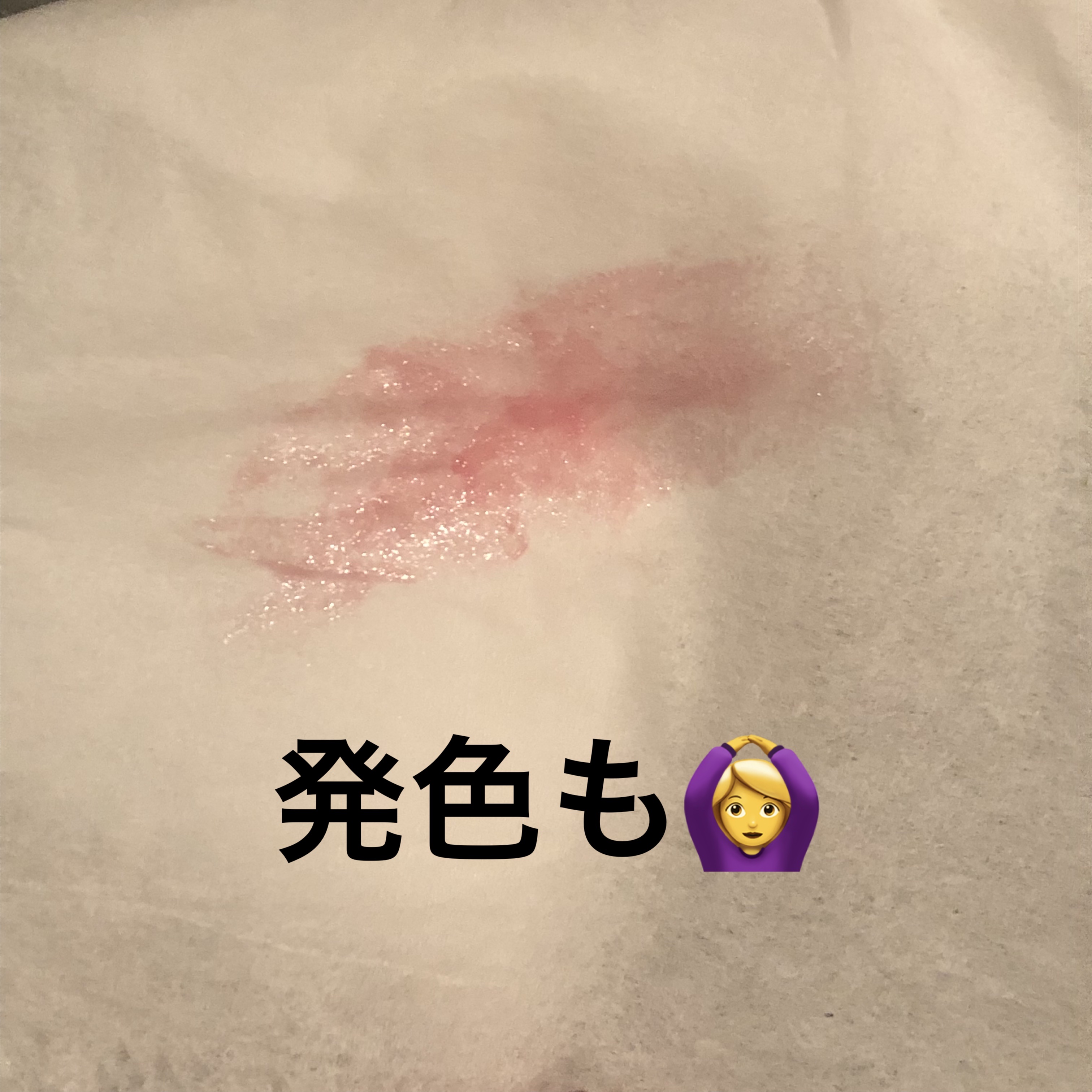 リップフォンデュ/メンソレータム/リップバームを使ったクチコミ（2枚目）