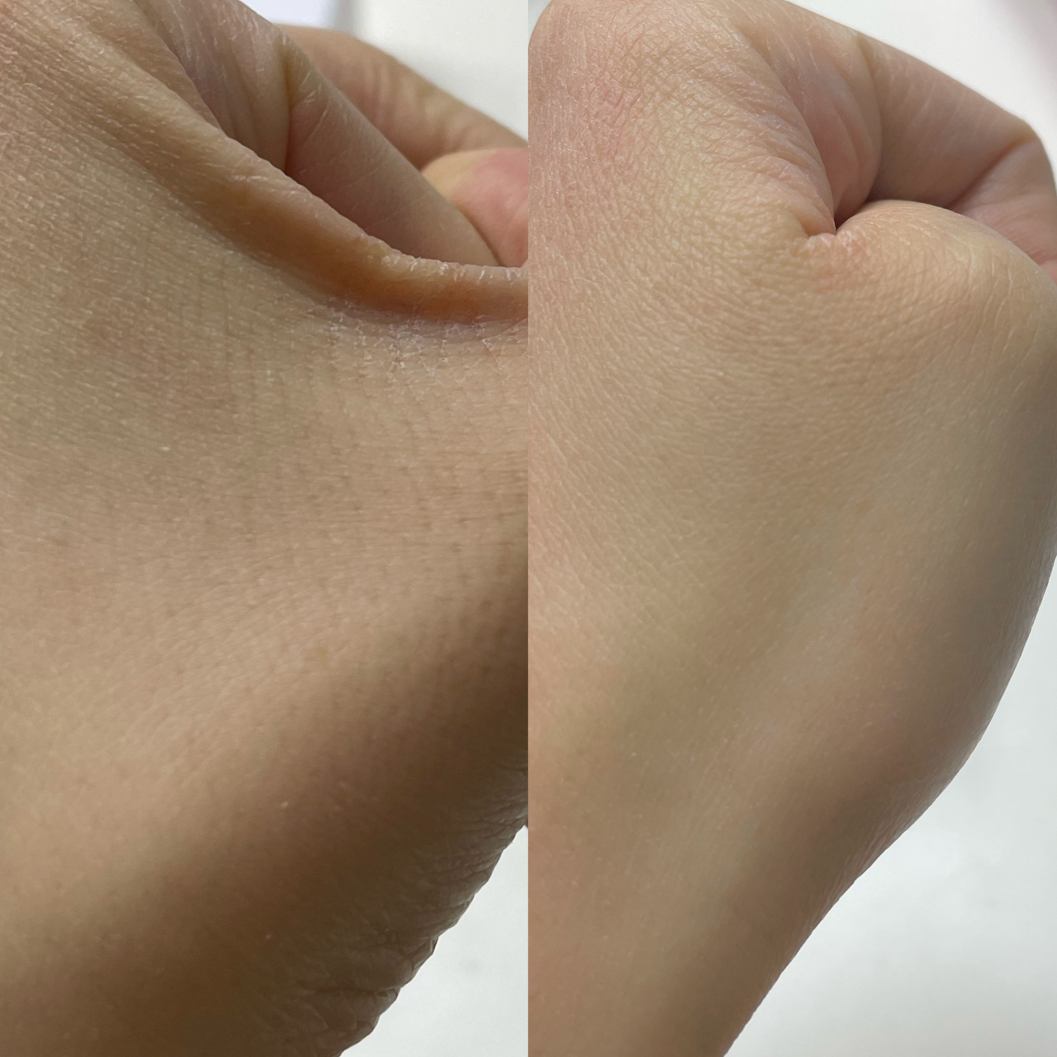 復活草クリーム ニュートリションチューブ/Abib /フェイスクリームを使ったクチコミ（2枚目）