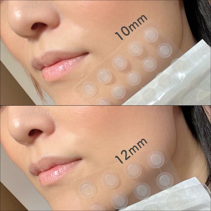 ビューティーミラクルパッチスポットカバー/Rael/にきびパッチを使ったクチコミ(4枚目)