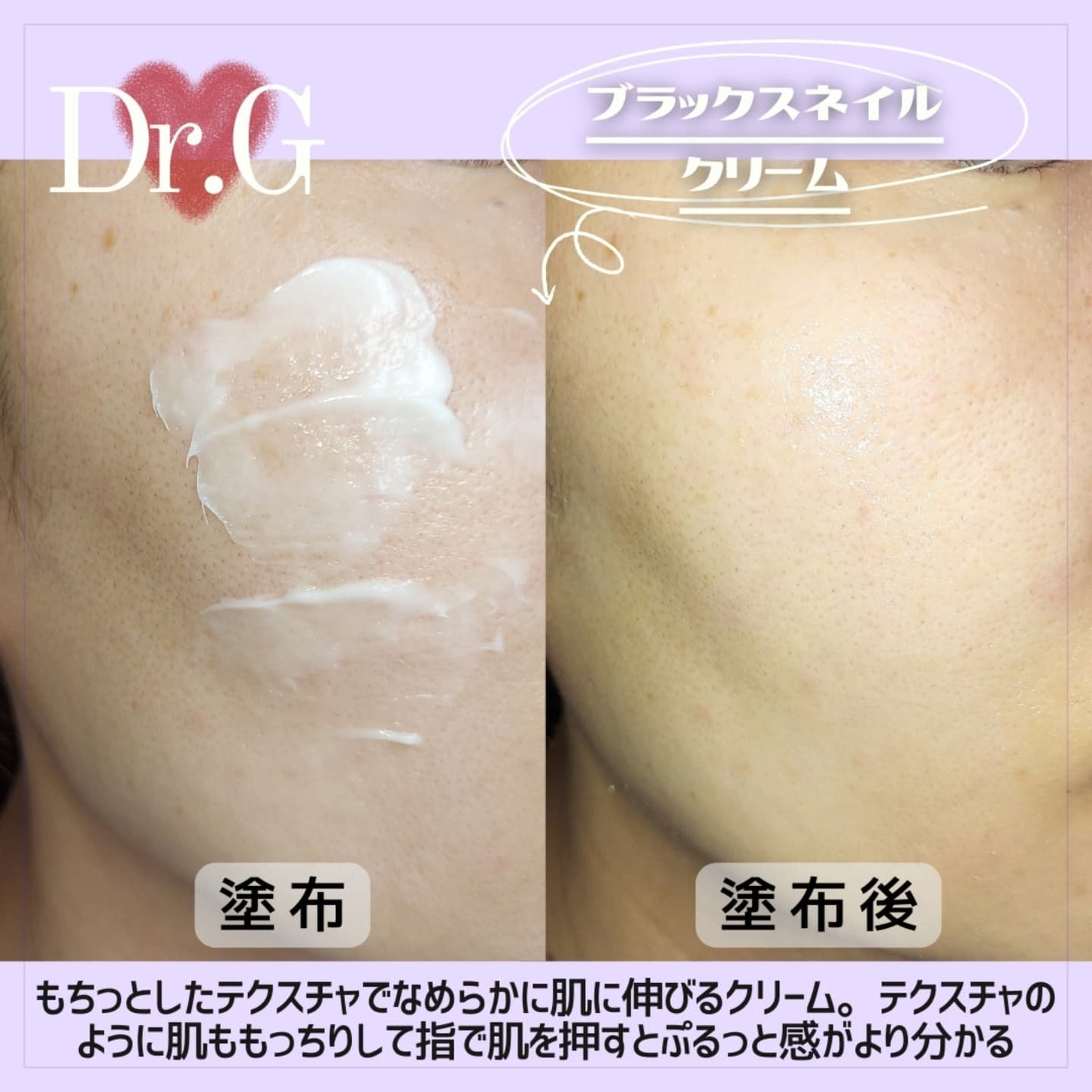 ブラックスネイル クリーム/Dr.G/フェイスクリームを使ったクチコミ(4枚目)