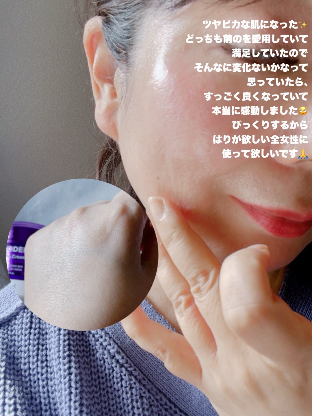 プロバイオダーム リフティングアンプル/BIOHEAL BOH/美容液を使ったクチコミ(8枚目)