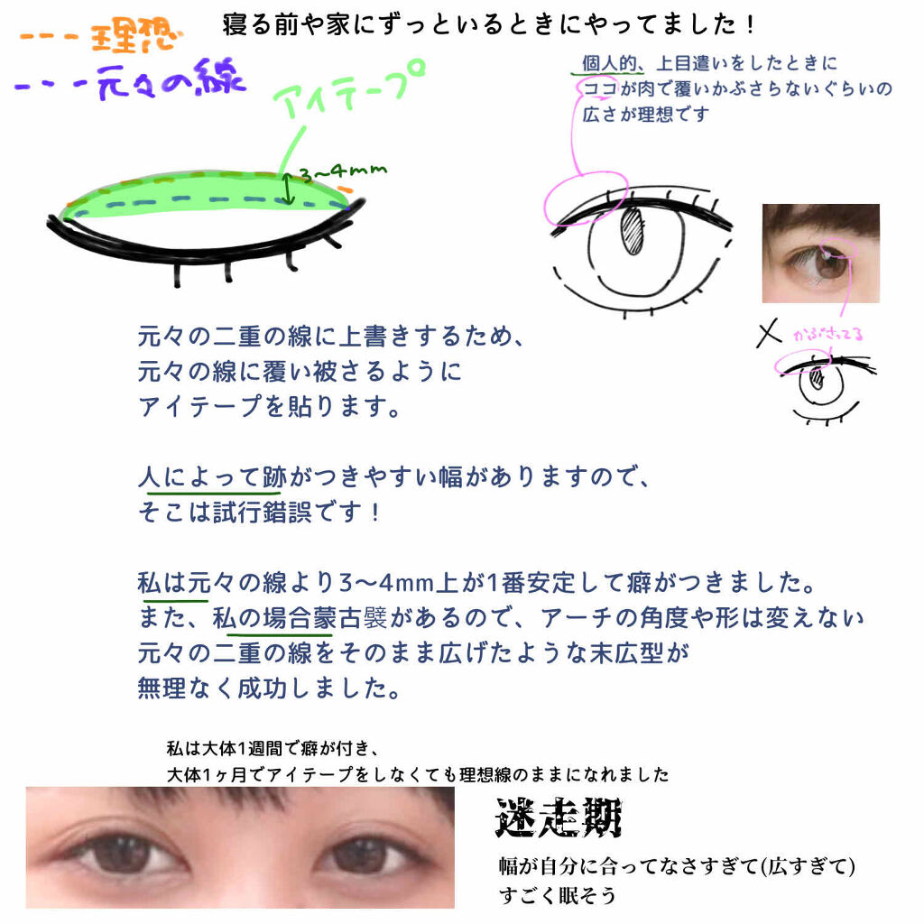 二重まぶた用シール/DAISO/二重まぶた用アイテムを使ったクチコミ（2枚目）