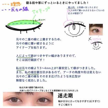 二重まぶた用シール/DAISO/二重まぶた用アイテムを使ったクチコミ(2枚目)