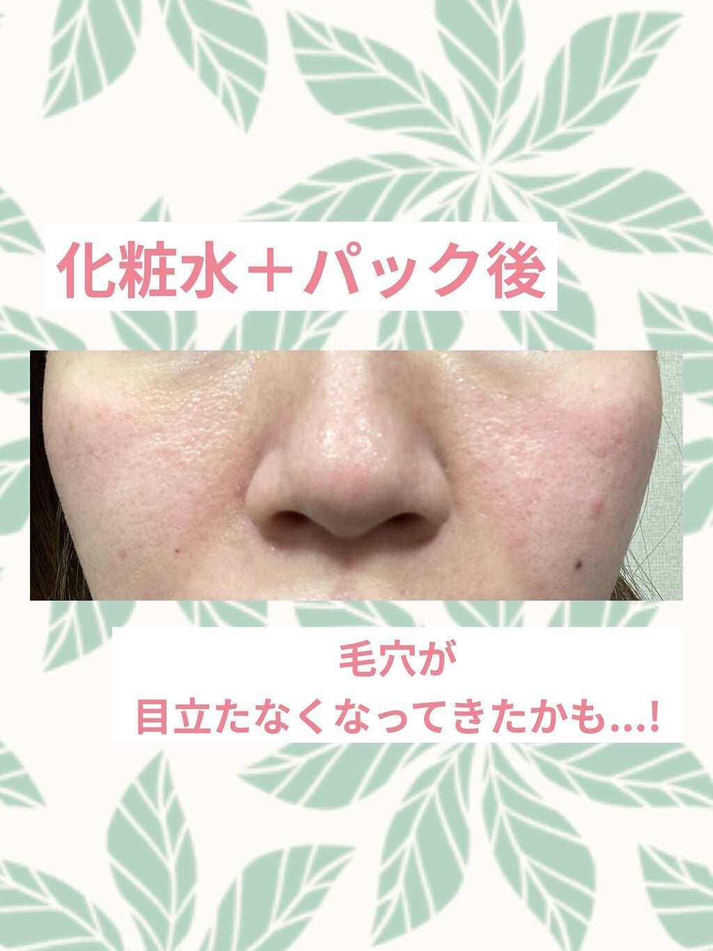 V エッセンス/unlabel/美容液を使ったクチコミ(6枚目)