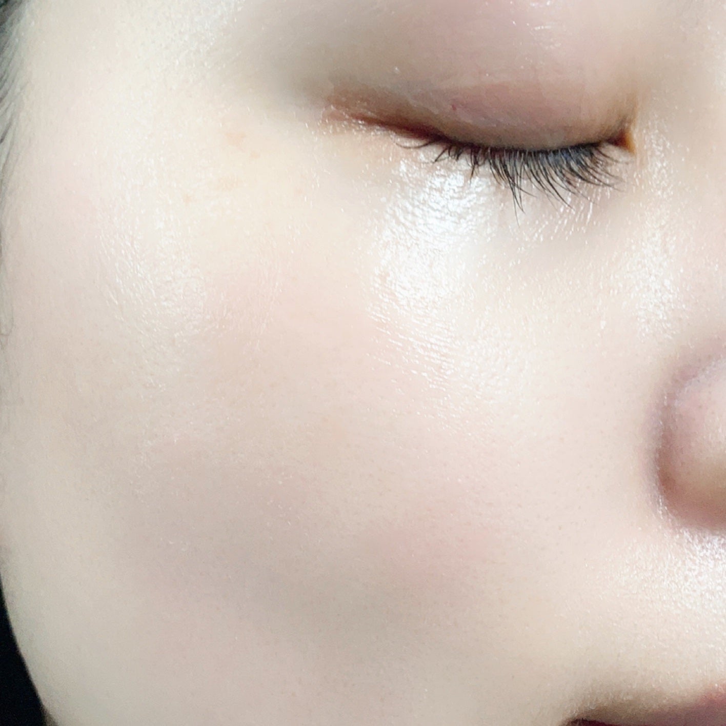 リンクルフィットマスク+ニードルローラー/MEDITHERAPY/美顔器・マッサージを使ったクチコミ(4枚目)