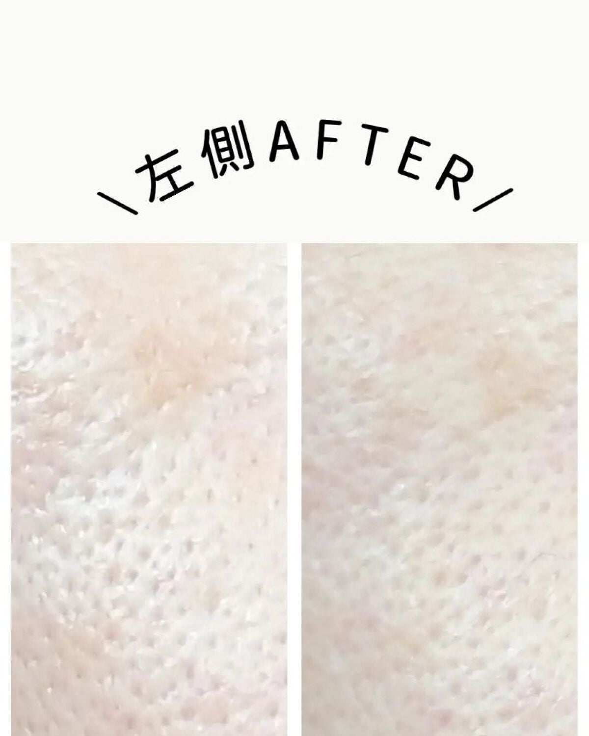 プラスソープHQ/プラスキレイ/洗顔石鹸を使ったクチコミ(2枚目)