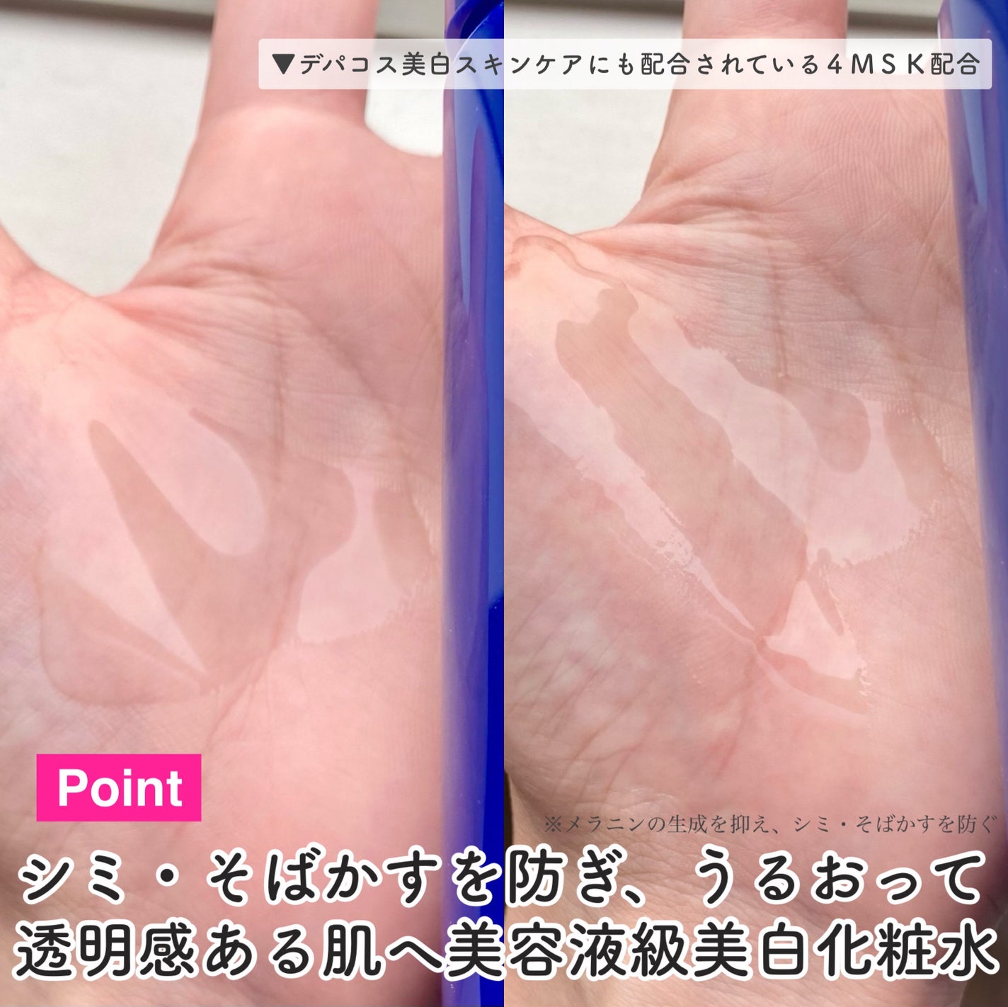 トリートメントローション (ブライトニング) とてもしっとり/アクアレーベル/化粧水を使ったクチコミ(5枚目)