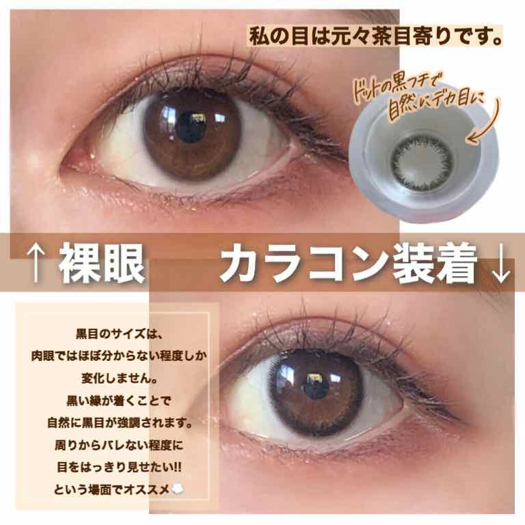 アーテラリ