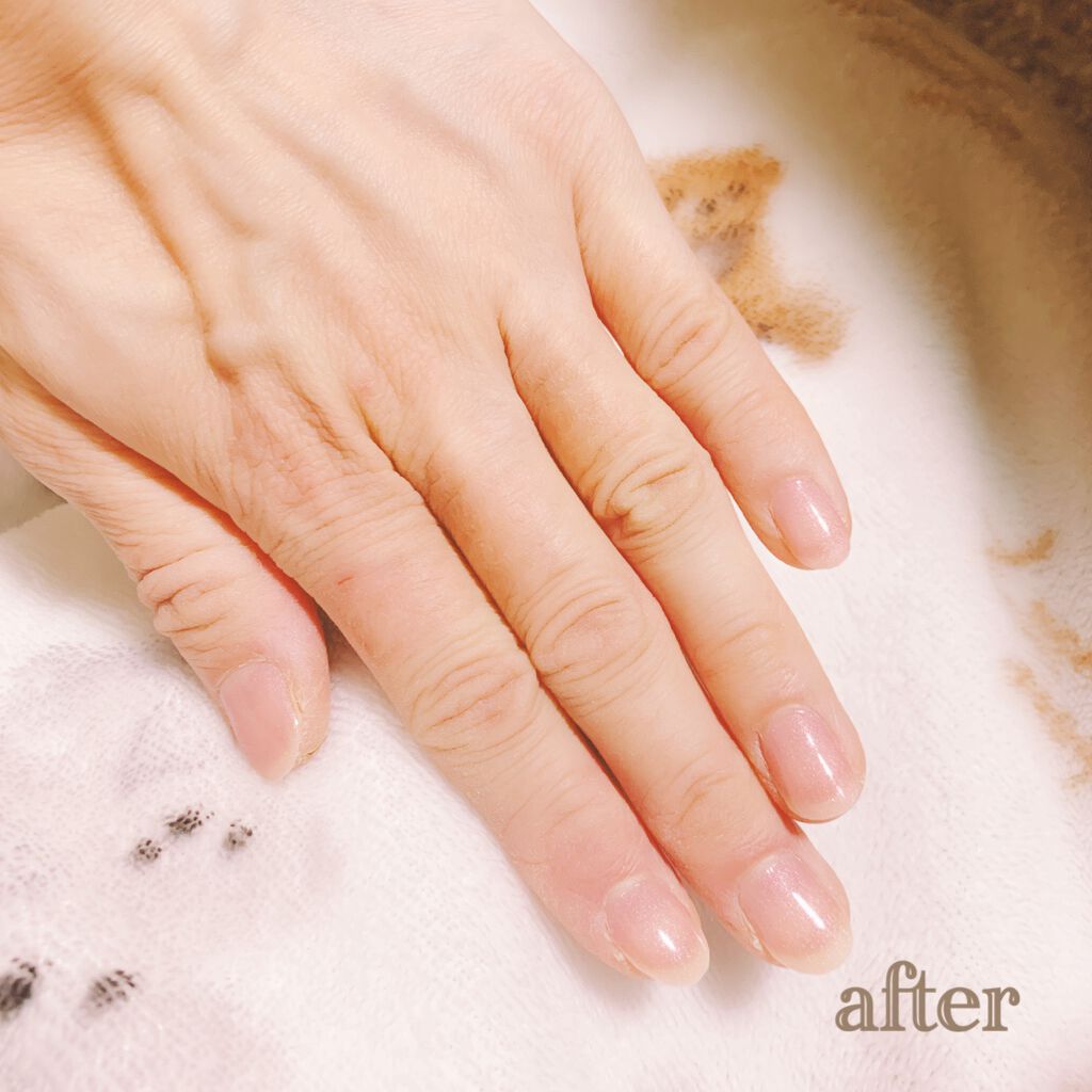 ウィークリージェル/HOMEI/ジェルネイルを使ったクチコミ(3枚目)