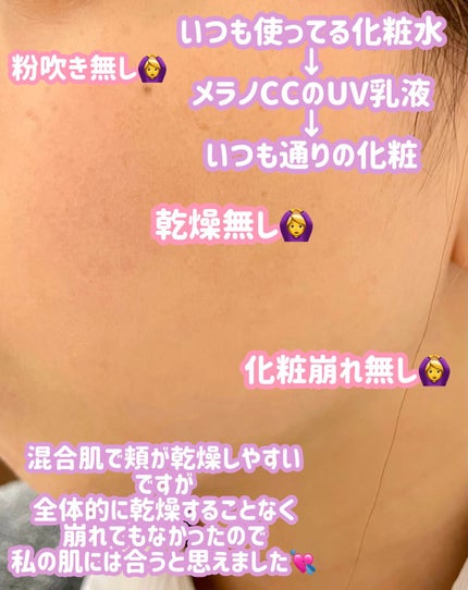 森田 on LIPS 「やっとマツキヨでゲットしたので雑に使用感投稿💪🍋メラノCCディ..」(3枚目)