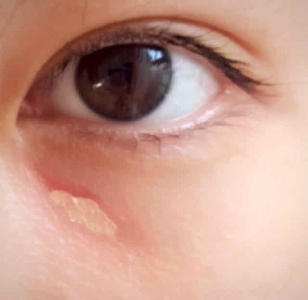 カバーパーフェクション チップコンシーラー/the SAEM/リキッドコンシーラーを使ったクチコミ(3枚目)