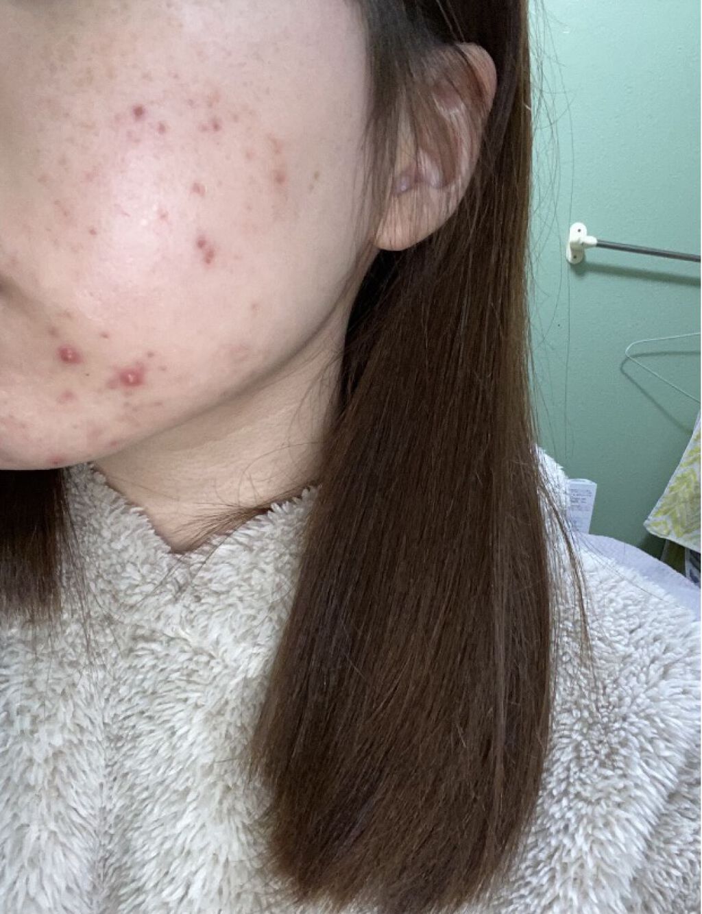 POWER　10　FORMULA　GF　EFFECTOR/It's skin/美容液を使ったクチコミ（3枚目）