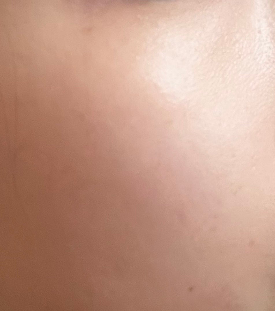 ピンクティーツリートナー/APLIN/化粧水を使ったクチコミ(4枚目)