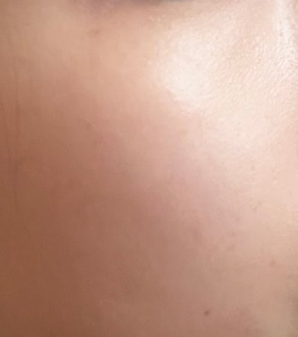 ピンクティーツリートナー/APLIN/化粧水を使ったクチコミ(4枚目)