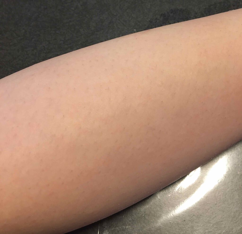 脱色クリーム 敏感肌用/エピラット/ムダ毛ケアを使ったクチコミ(3枚目)
