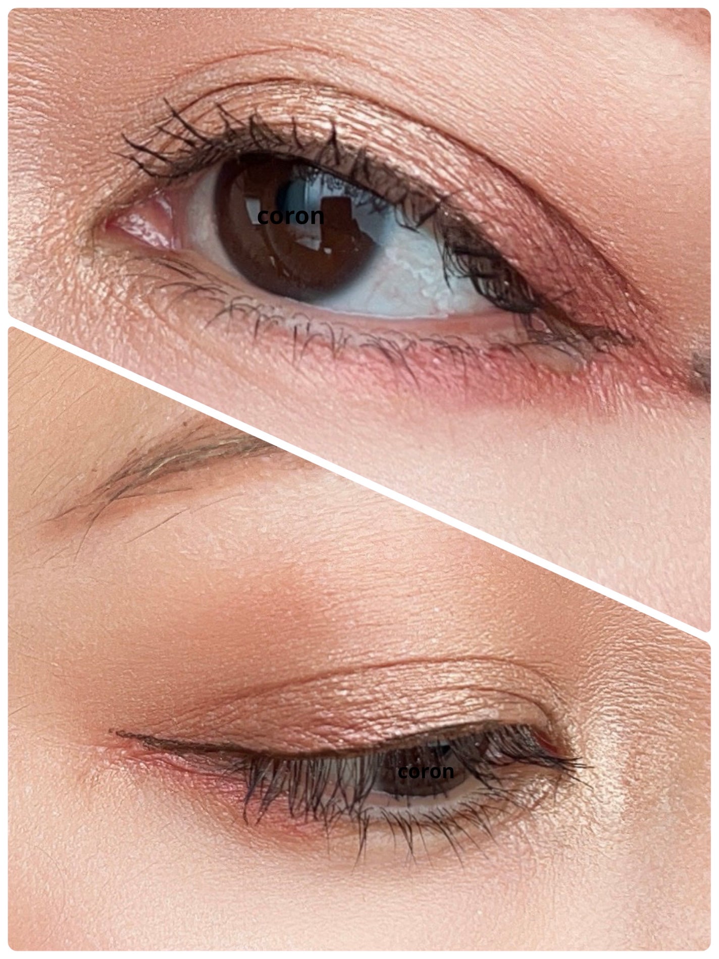 ãã³ã°ïŒã«ãŒã«ãã¹ã«ã© ã¢ããã³ã¹ããã£ã«ã /ããã€ã³ã¡ã€ã¯/ãã¹ã«ã©ã䜿ã£ãã¯ãã³ãïŒ2æç®ïŒ