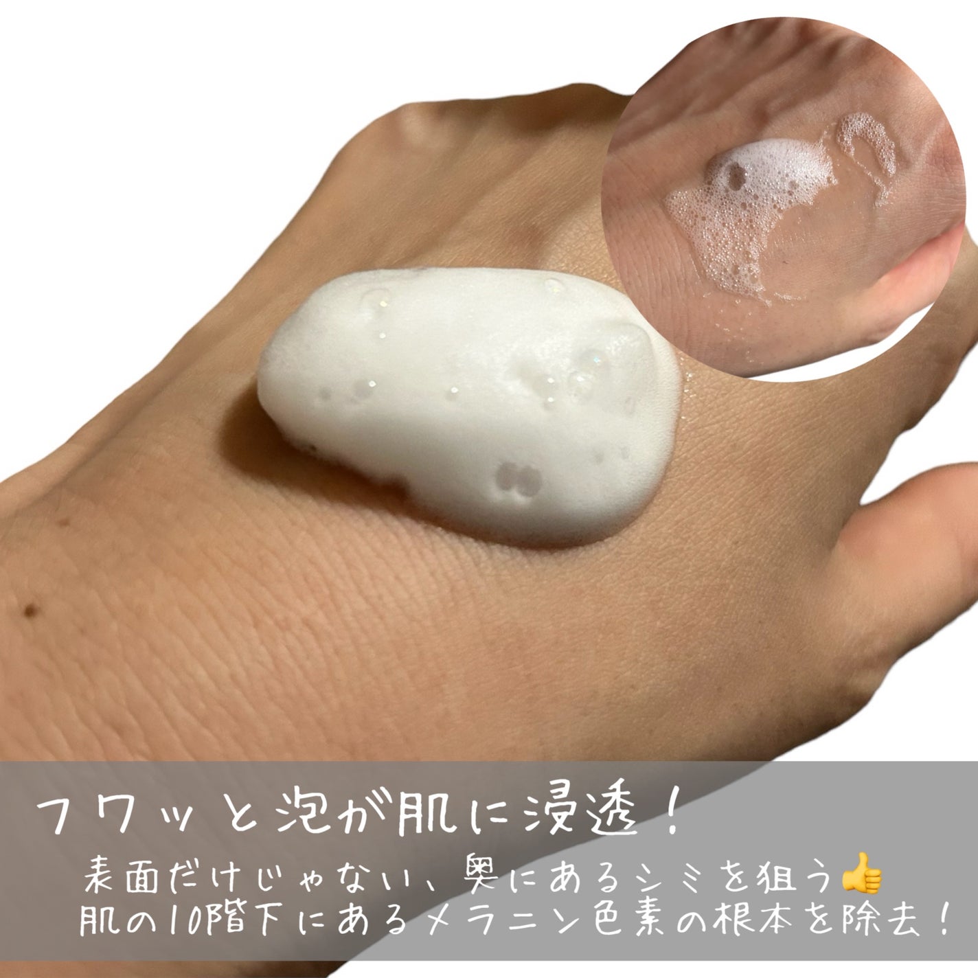 バイタルイミュンショットファーストバブルセラム/SKIN SIGNAL/美容液を使ったクチコミ(3枚目)