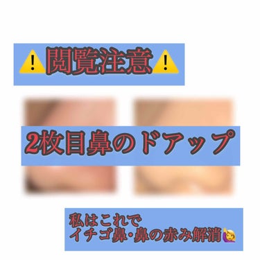 お久しぶりです はなさきです！

最近ずーっと悩んでた イチゴ鼻･鼻の赤みを
108円で改善した方法をお教えします💰

(個人差があるかもしれません そこはご了承ください😭)

改善するために使ったもの