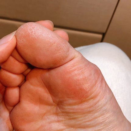 イージーパックDP60分タイプ/ベビーフット/レッグ・フットケアを使ったクチコミ(5枚目)