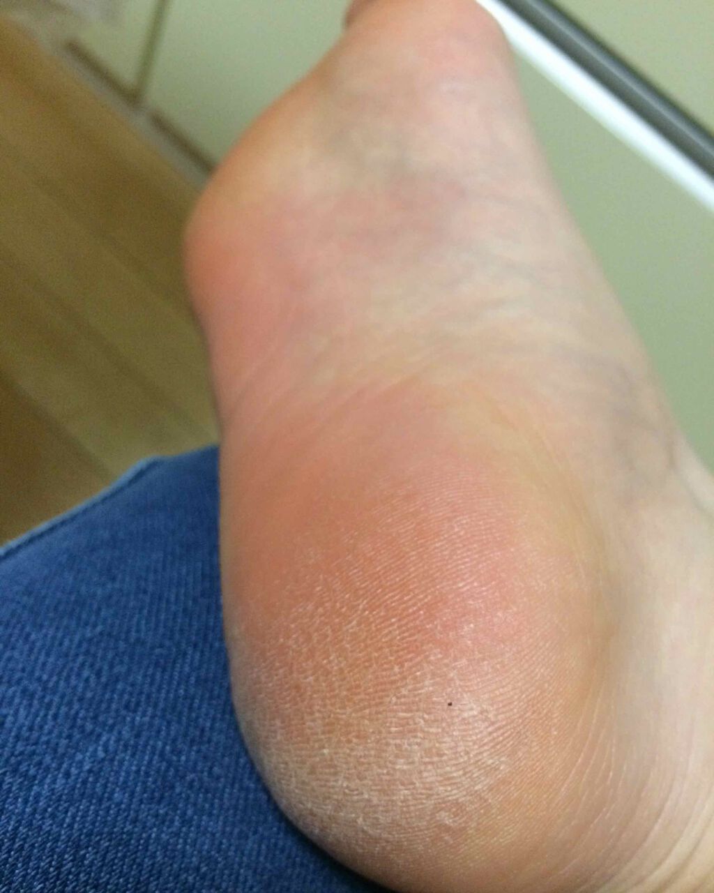 イージーパックDP60分タイプ/ベビーフット/レッグ・フットケアを使ったクチコミ（3枚目）