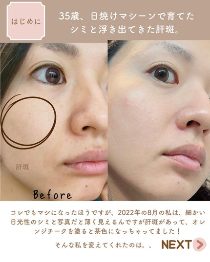 Tranexamic Acid Niacinamide/コスデバハ/美容液を使ったクチコミ(2枚目)