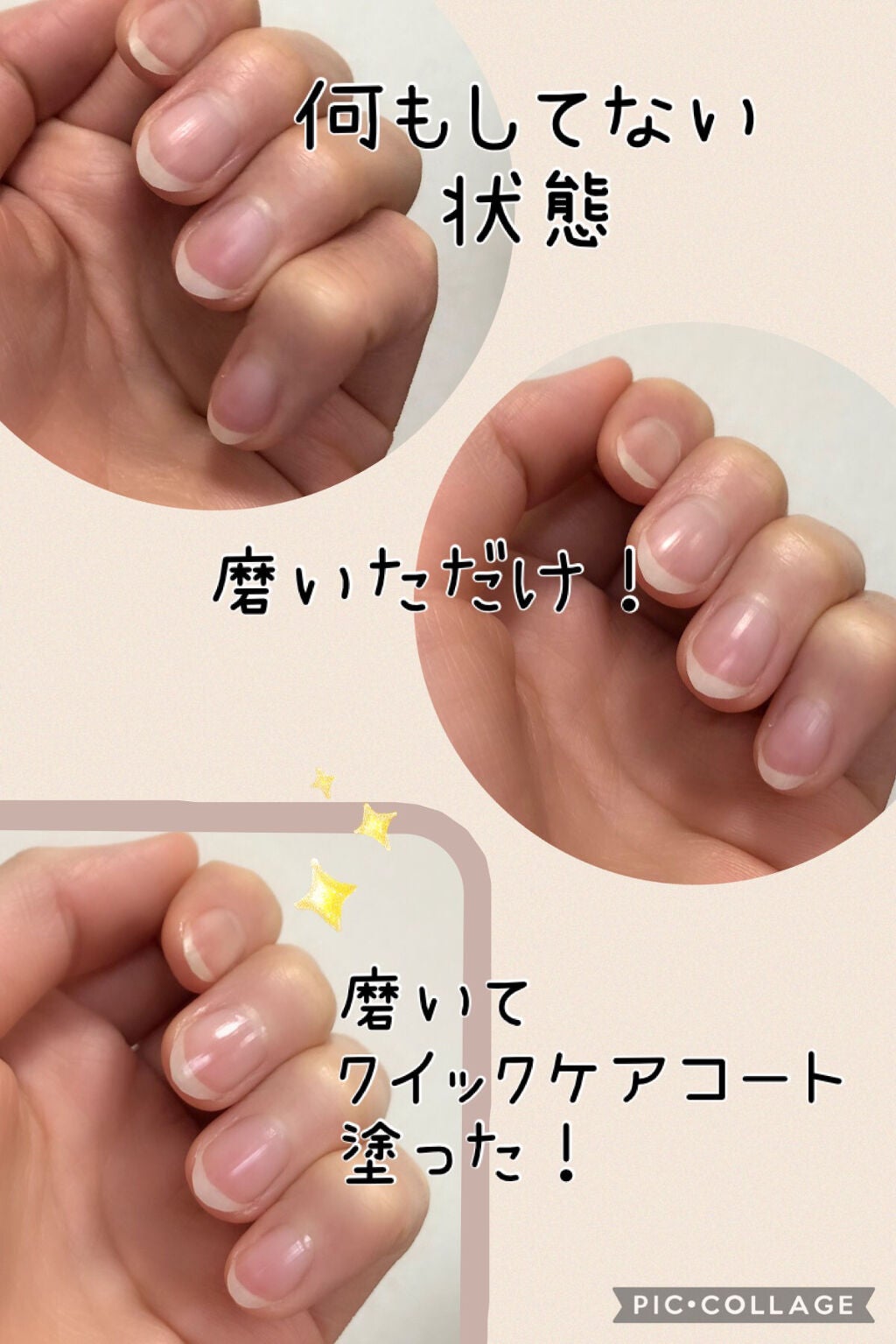 エテュセ クイックケアコート/ettusais/ネイルオイル・トリートメントを使ったクチコミ(3枚目)