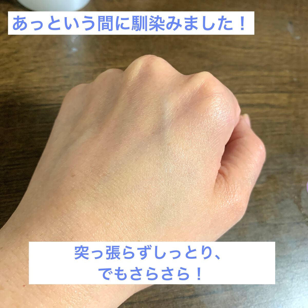 メディプラスゲル/メディプラス/オールインワン化粧品を使ったクチコミ(6枚目)