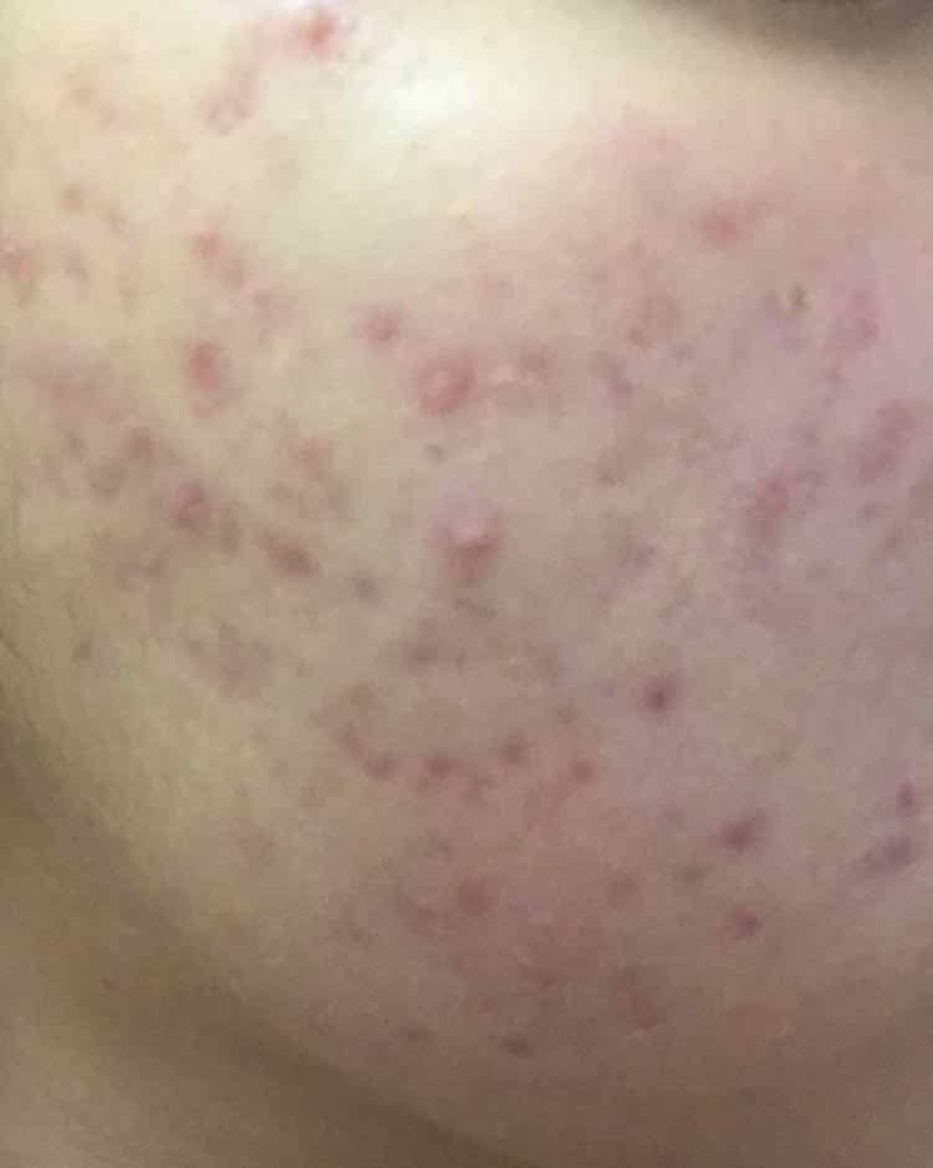 ハトムギ化粧水(ナチュリエ スキンコンディショナー R )/ナチュリエ/化粧水を使ったクチコミ(3枚目)