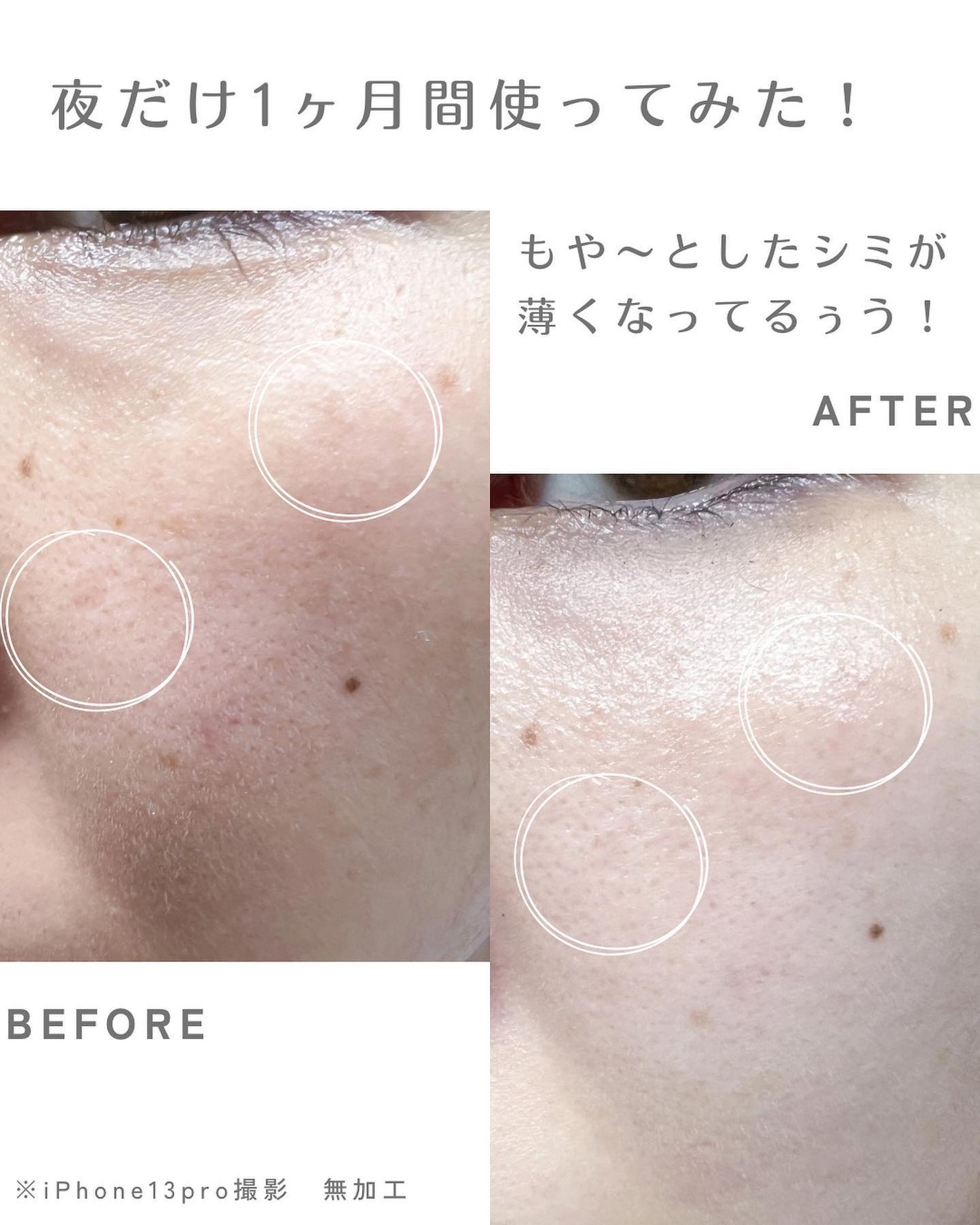 SXS ブライトエクスペリエンスキット/ホワイトショット/スキンケアキットを使ったクチコミ(6枚目)