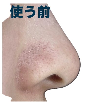 ノーズピーリングパック/One-day's you/シートマスク・パックを使ったクチコミ(6枚目)