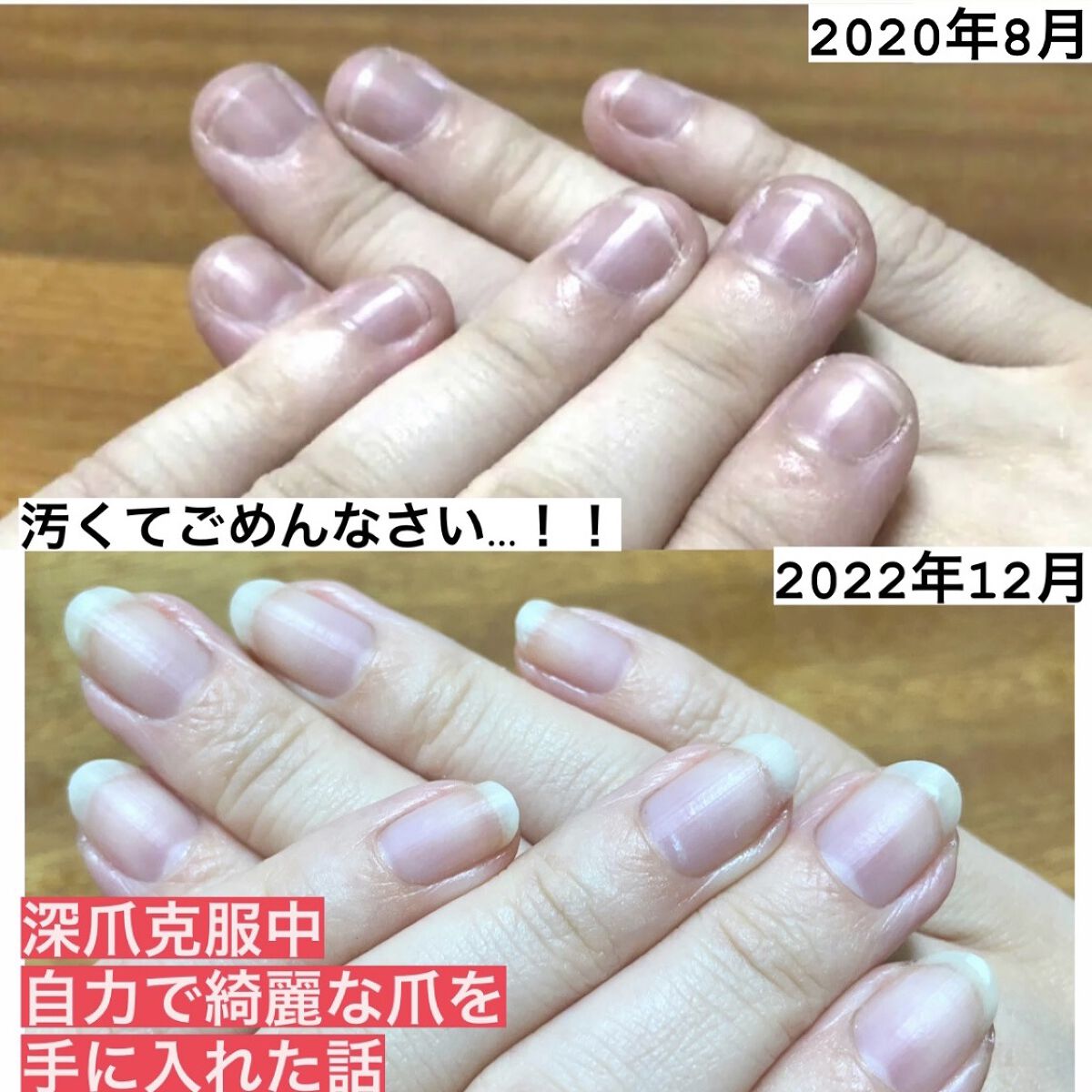 オリジナル ピュアスキンジェリー/ヴァセリン/ボディクリームを使ったクチコミ（1枚目）