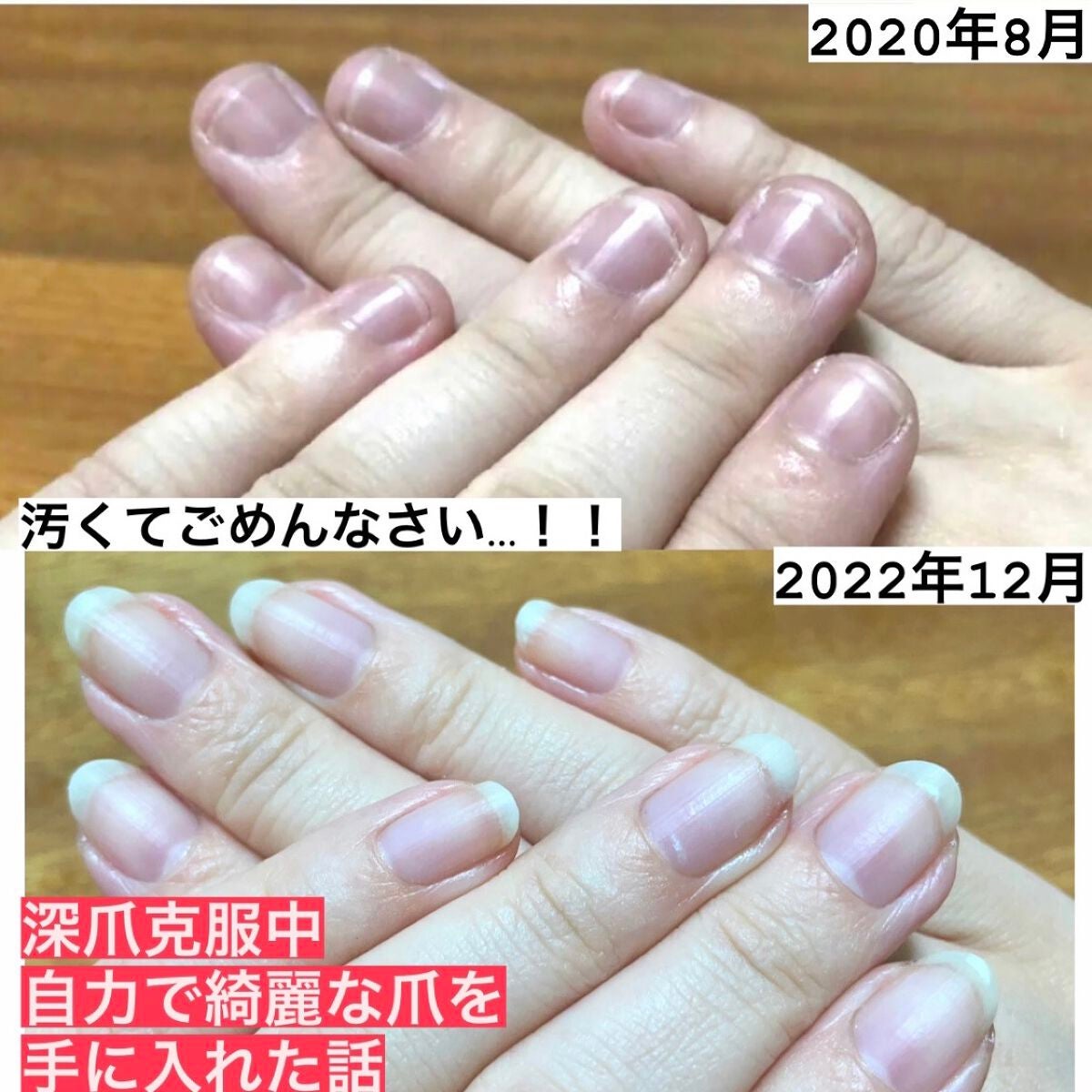 オリジナル ピュアスキンジェリー/ヴァセリン/ボディクリームを使ったクチコミ(1枚目)