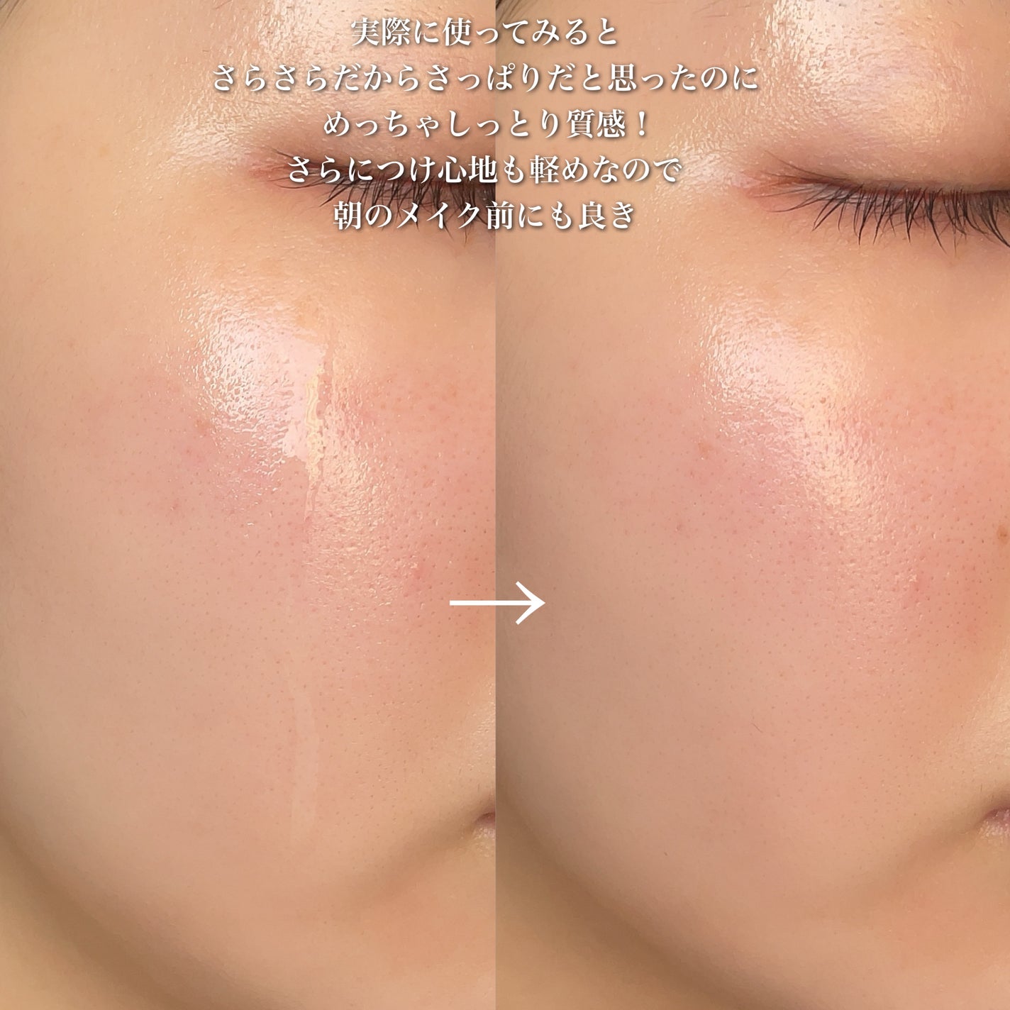 プロポリスレスキューアンプル 50ml/CNP Laboratory/美容液を使ったクチコミ(6枚目)