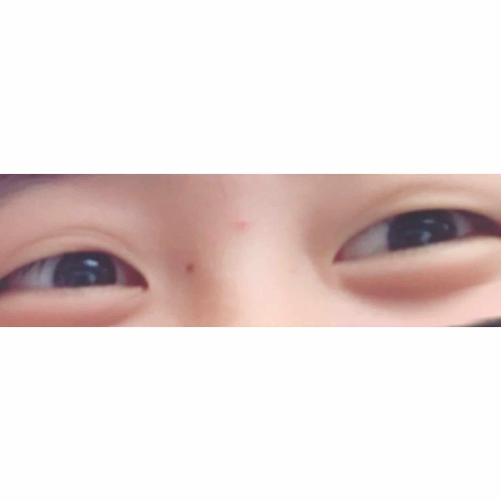 のびーるアイテープ（絆創膏タイプ、レギュラー）/DAISO/二重まぶた用アイテムを使ったクチコミ（2枚目）