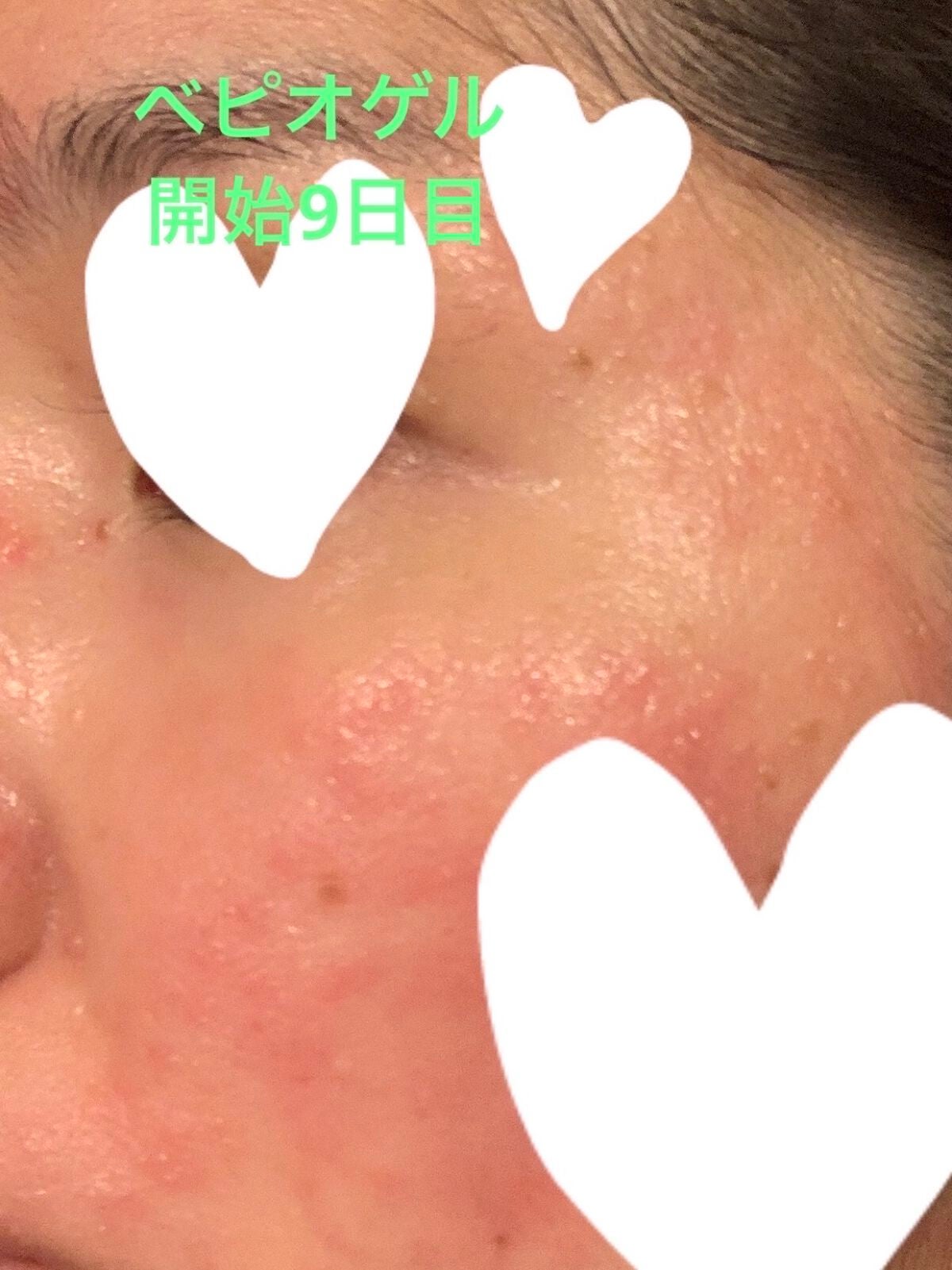 ルルルンピュア エブリーズ/ルルルン/シートマスク・パックを使ったクチコミ(3枚目)