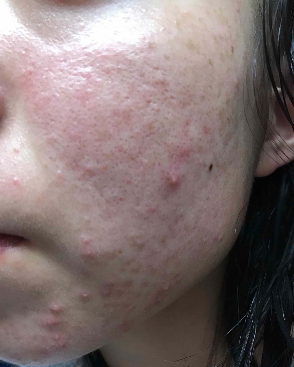 ドクタージャルト シカペア クリーム (第2世代)/Dr.Jart+/フェイスクリームを使ったクチコミ(3枚目)