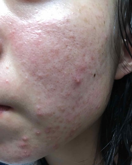 ドクタージャルト シカペア クリーム (第2世代)/Dr.Jart+/フェイスクリームを使ったクチコミ(3枚目)