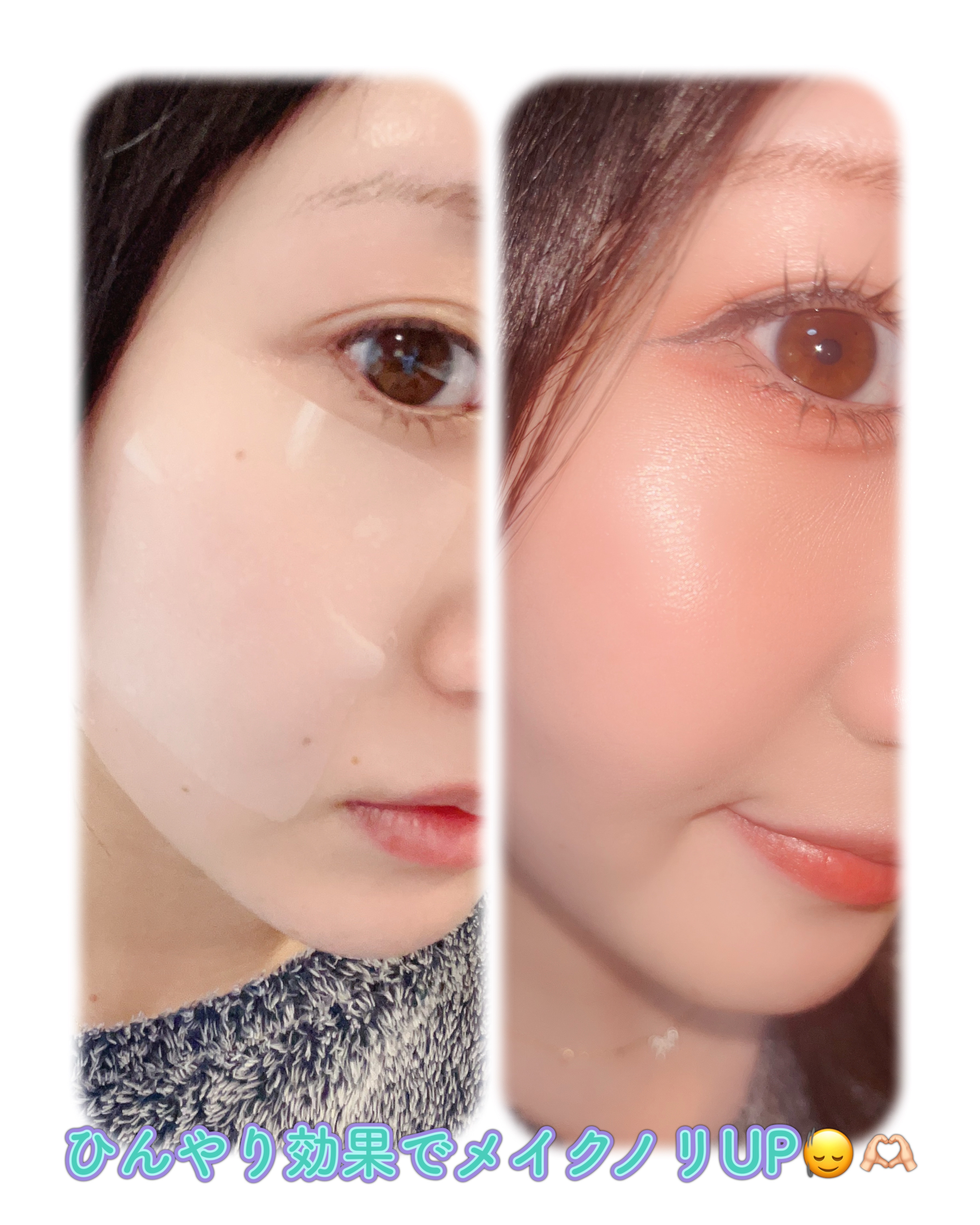 クーリングスクエアパック/ICY ZAP/シートマスク・パックを使ったクチコミ（3枚目）