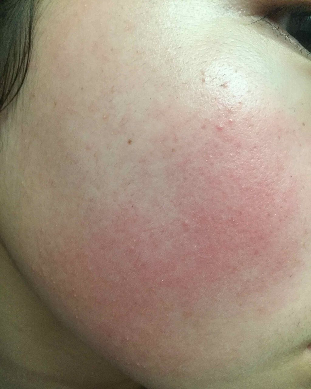 クリアターン ベイビッシュ ホワイトマスク/クリアターン/シートマスク・パックを使ったクチコミ(2枚目)