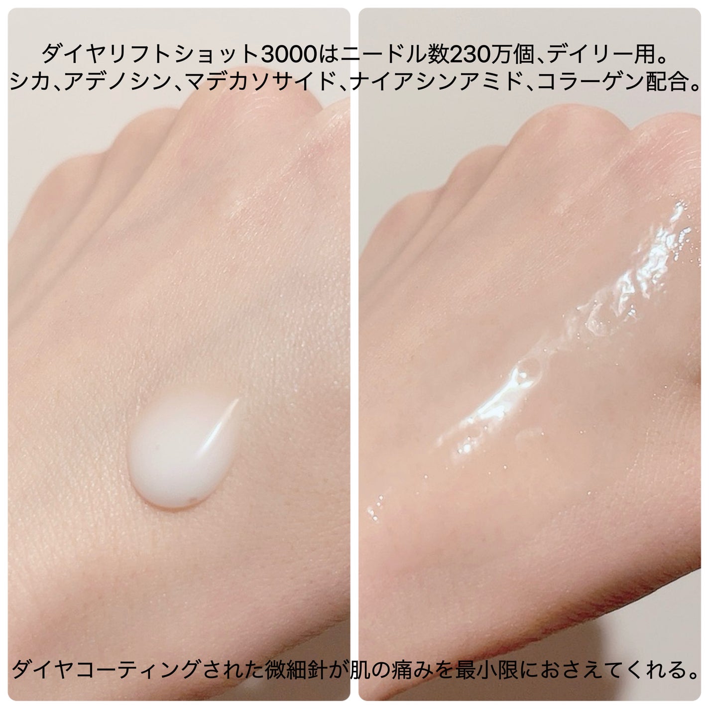 ダイヤリフト3000ショット/ECLIMOI/フェイスクリームを使ったクチコミ(2枚目)