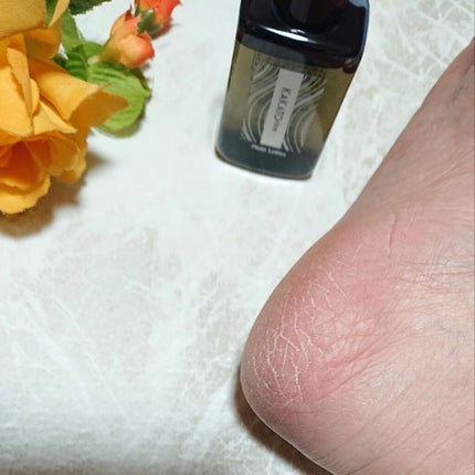 カカトリーヌモイストローション/KAKATOrine/レッグ・フットケアを使ったクチコミ(5枚目)