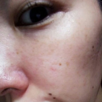 ラメラエッセンスC/セルベスト/美容液を使ったクチコミ(4枚目)