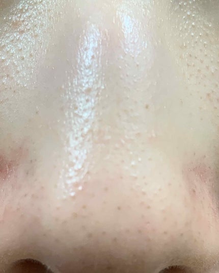 ãã«ãª é»ãã¿åžç ã¬ã¹ãŒã«ããã¯/ãã«ãª/æŽãæµãããã¯ã»ãã¹ã¯ã䜿ã£ãã¯ãã³ãïŒ3æç®ïŒ