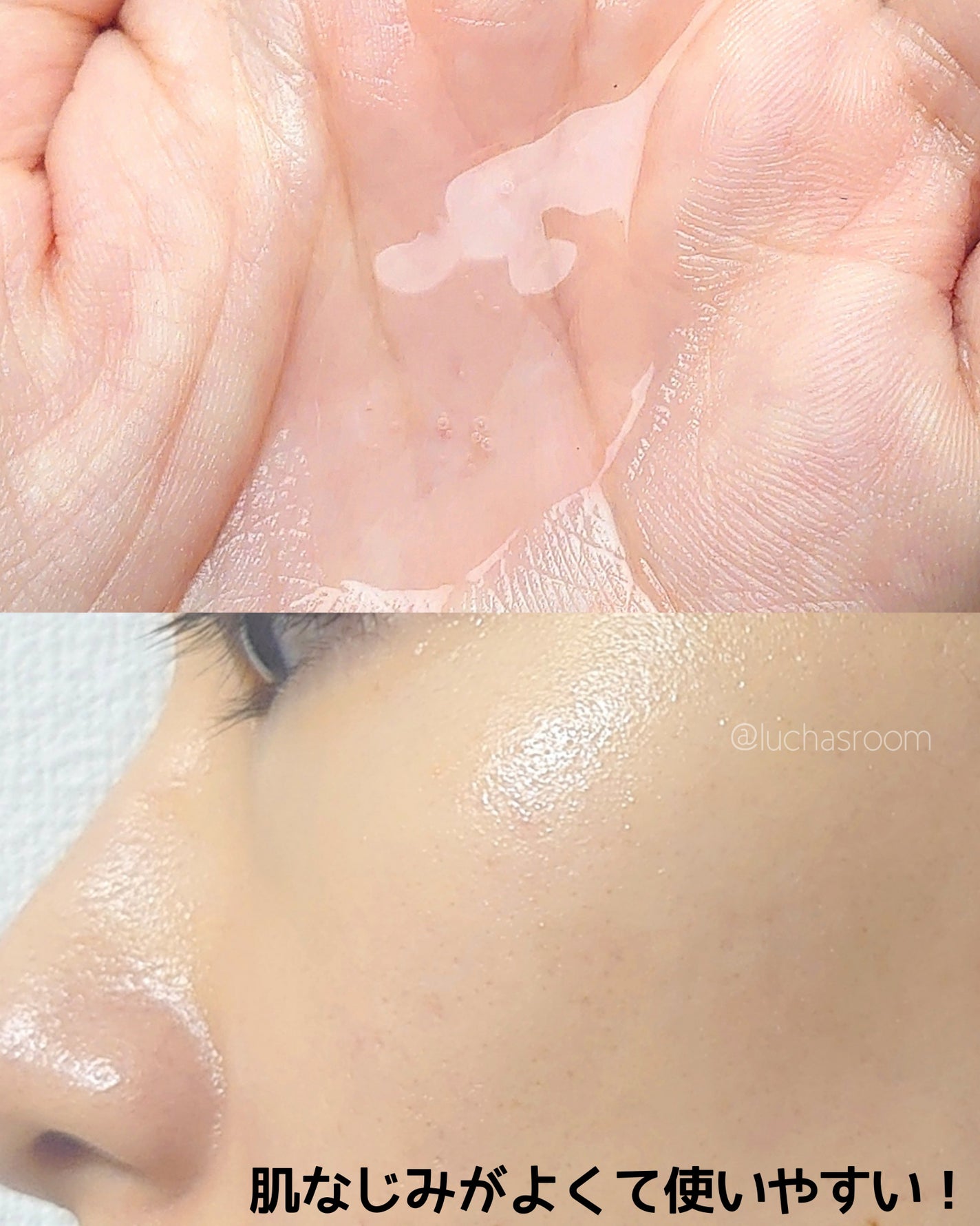 ピンクティーツリーシナジーセラム/APLIN/美容液を使ったクチコミ(4枚目)