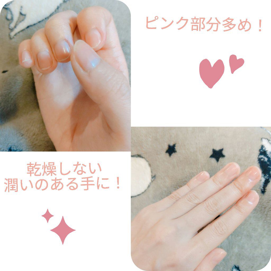 ハンドクリーム/アトリックス/ハンドクリームを使ったクチコミ（2枚目）