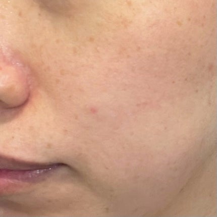 ティーツリーオイルパック/NOWATER/シートマスク・パックを使ったクチコミ(8枚目)