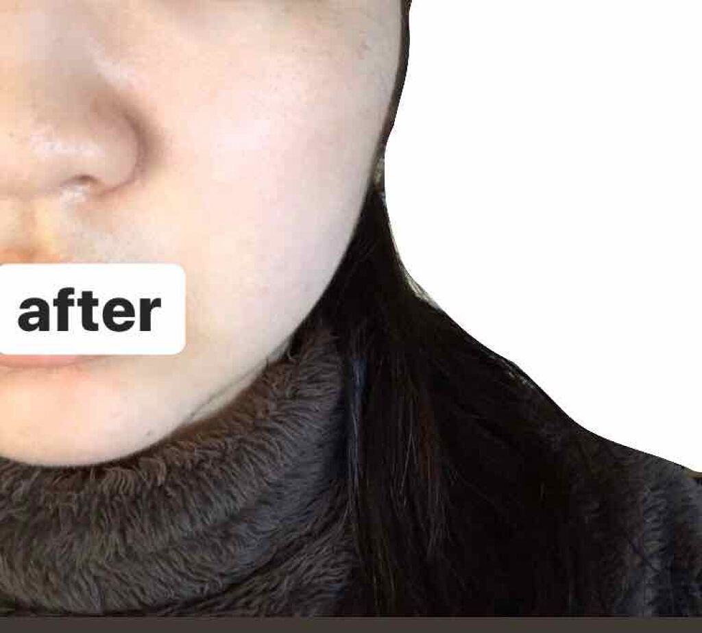 ミノン アミノモイスト モイストチャージ ミルク/ミノン/乳液を使ったクチコミ（3枚目）